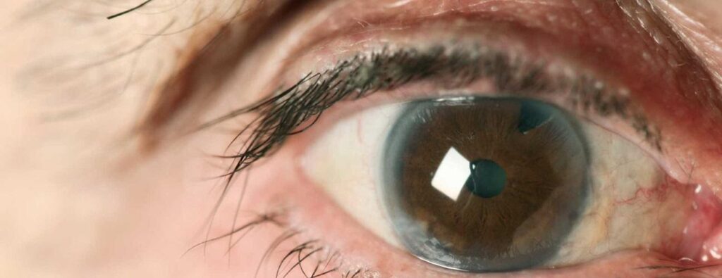 Cataracts | Johns Hopkins Medicine